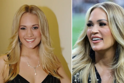 carrie underwood plastic surgery